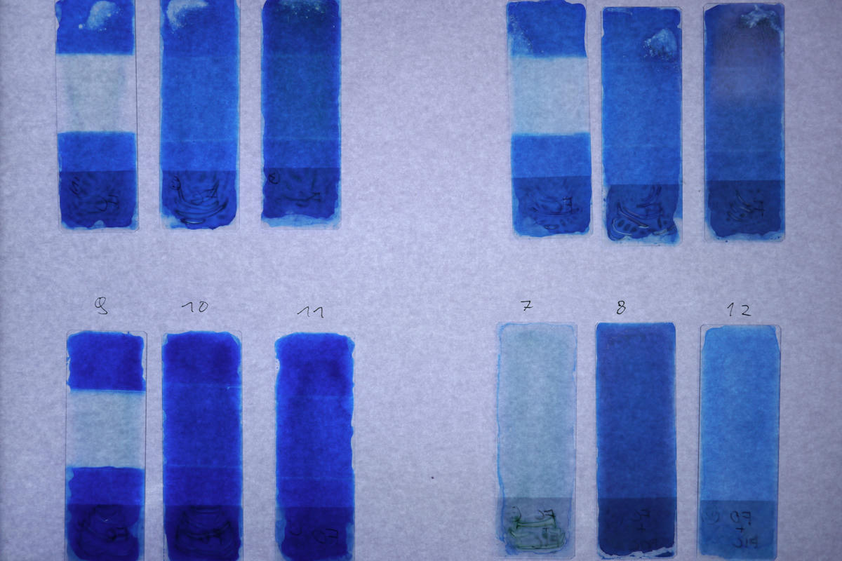 Slides on a light table for a better look